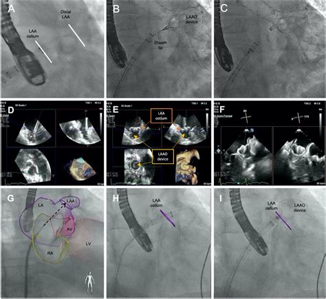 A hybrid echocardiography.